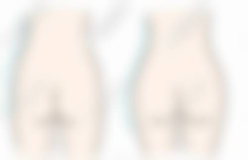 五、包头现代女子医院整形美容中 心实例