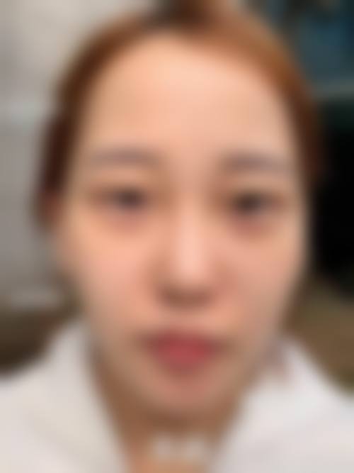 五、佛山普玥整形医院实例