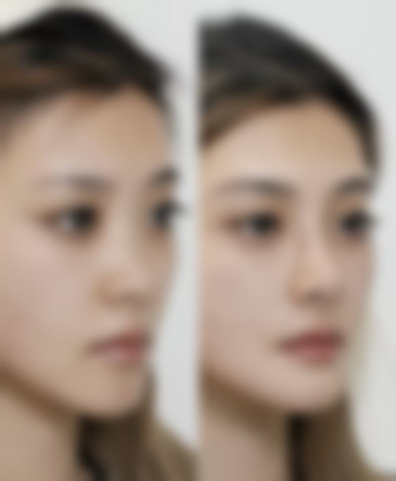 五、长沙卓而美医疗美容实例