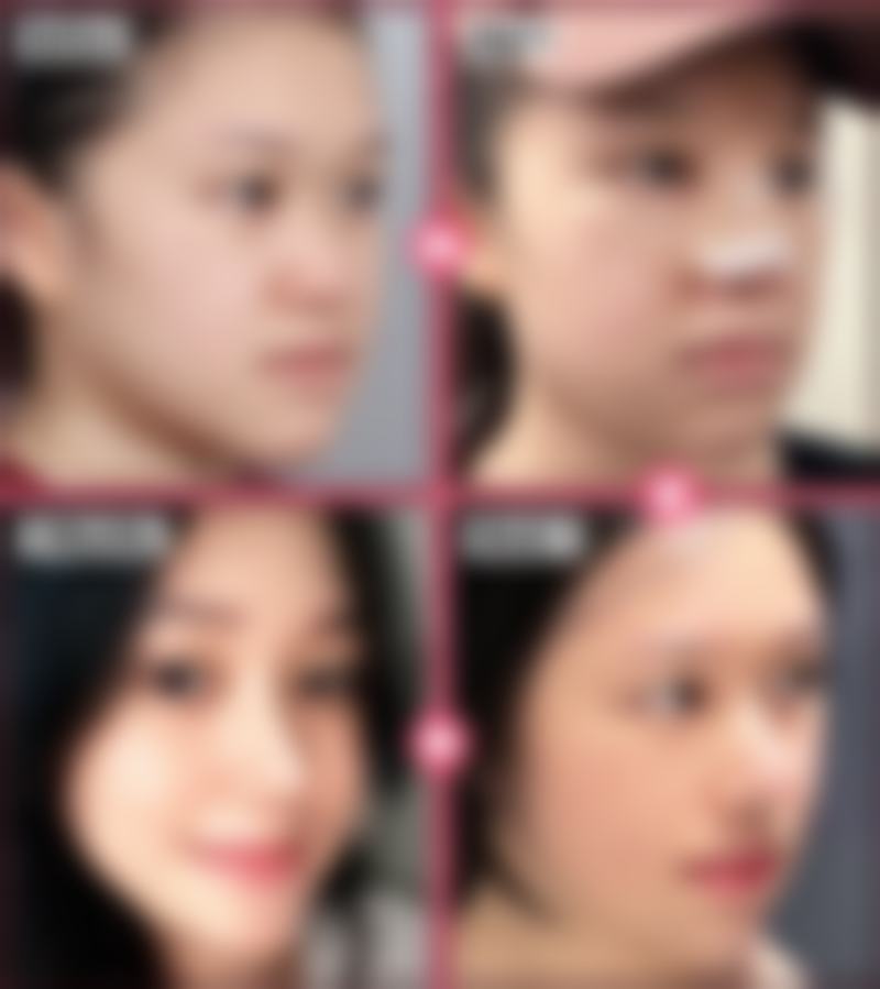 八、哈尔滨美辰整形医院真实的顾客评价如下：