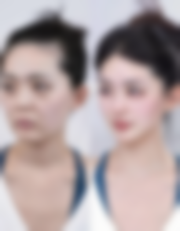 汤玉祥医生口碑和评价