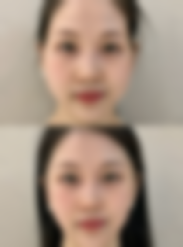 孩子脸上留疤了，日常基础护理来帮忙