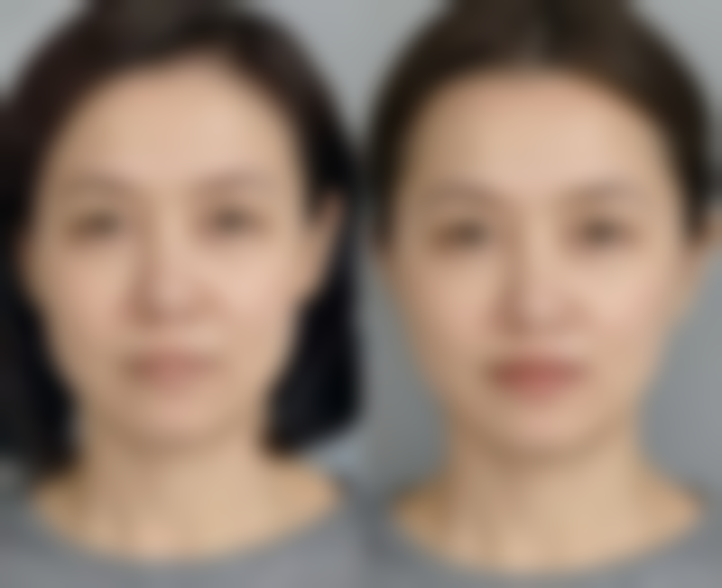 六、韩国延世白整形外科医院怎么预约：