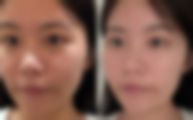 汤玉祥医生怎么样可靠吗？