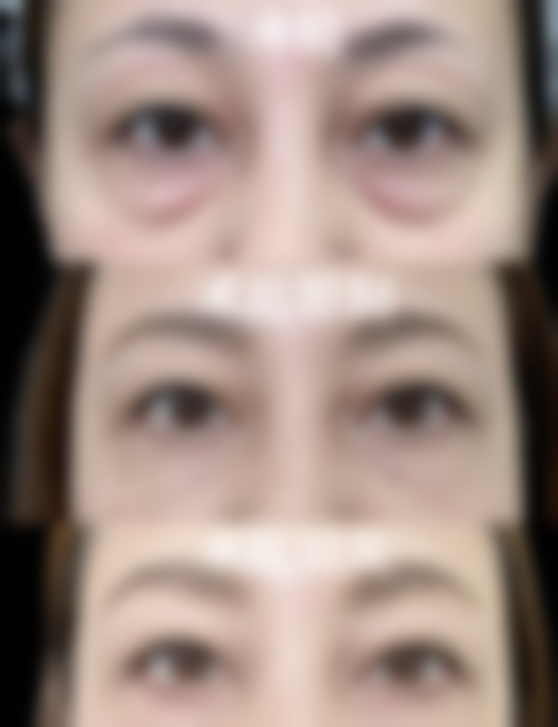 高文彬医生在哪家医院怎么预约？