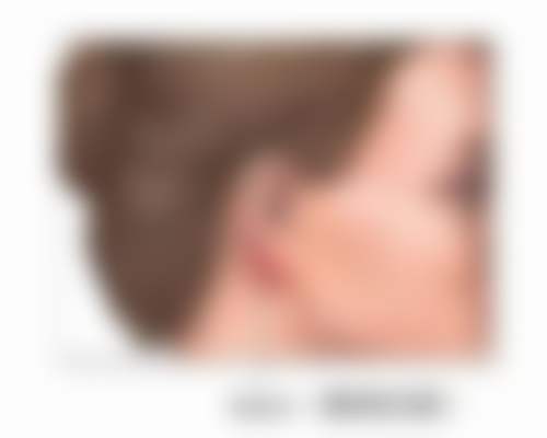 切缝疤痕手术修复的优势及注意事项