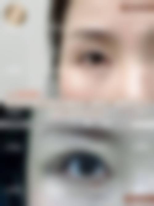 李伟东医生实例