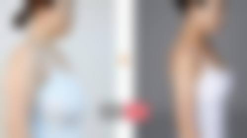 四、惠州瑞悦美医疗美容实例