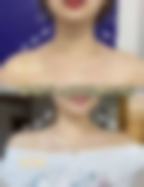 五、济南民生医院整形科实例