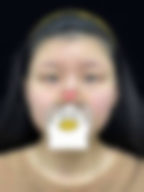 六、惠州瑞悦美医疗美容价格表：（仅供参考）