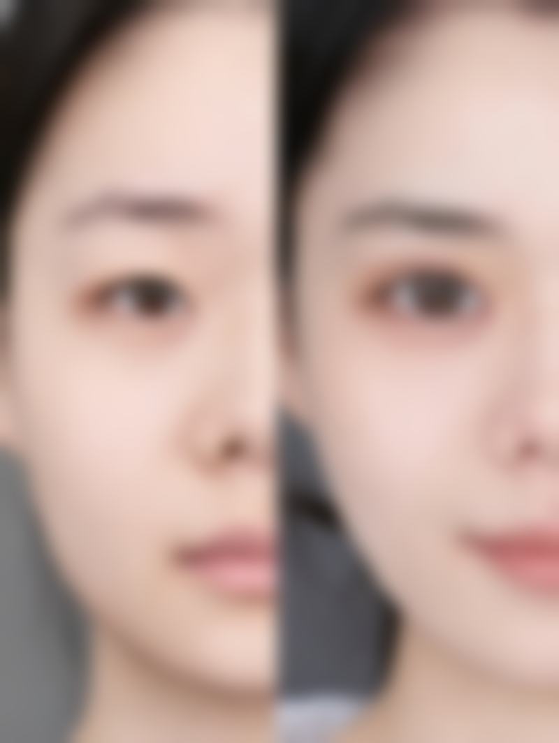 吸脂一个半月后，合理饮食助你持续瘦