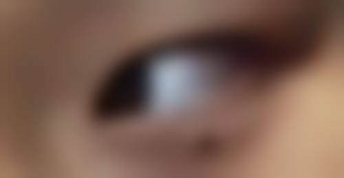 显著减重：肚子抽脂带来的体重变化