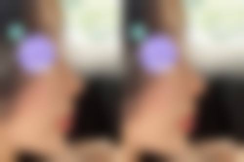 八、东莞君熠医疗美容整形医院真实的顾客评价如下：