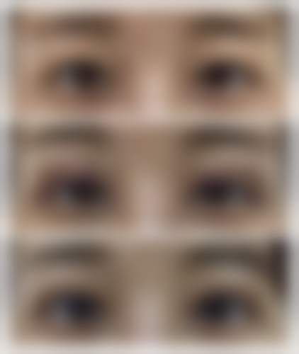 七、广州缔妍医疗美容门诊部价格表：（仅供参考）