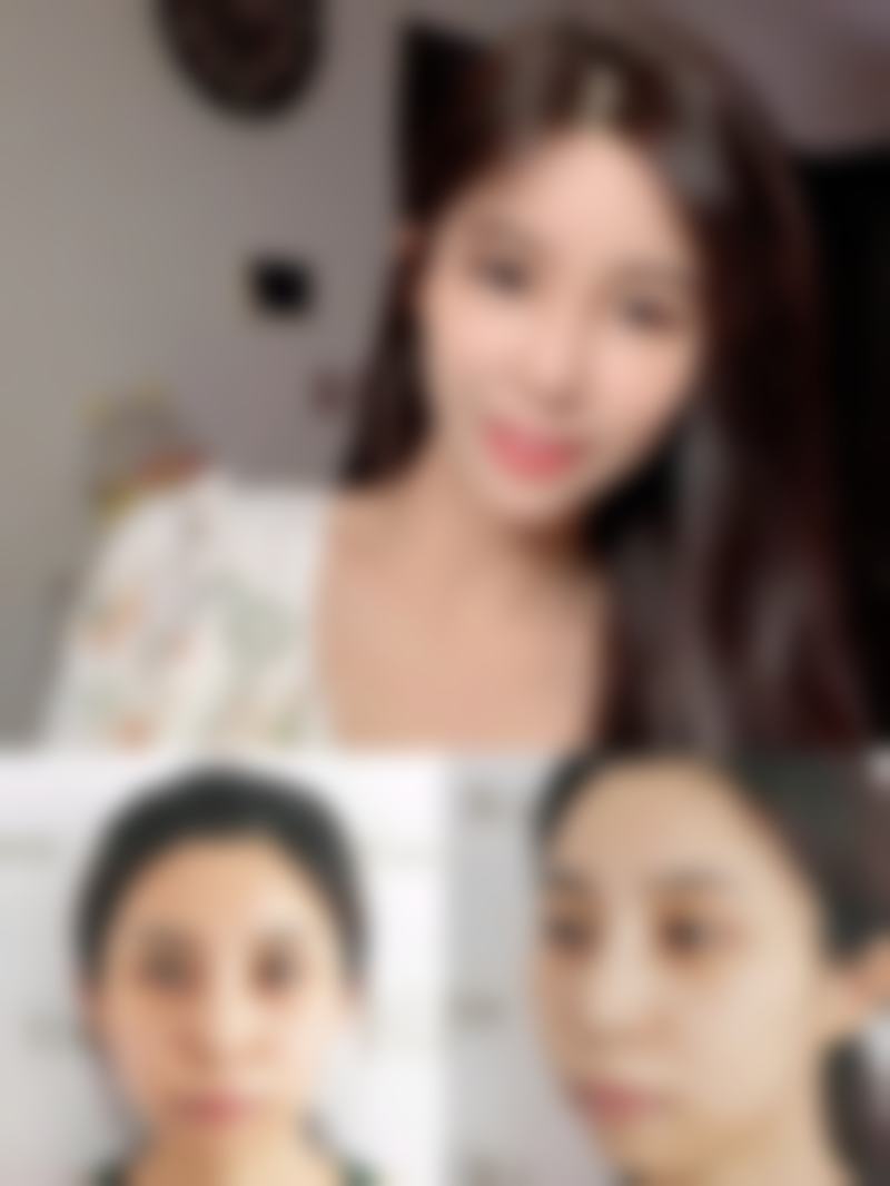 王慧茹医生实例