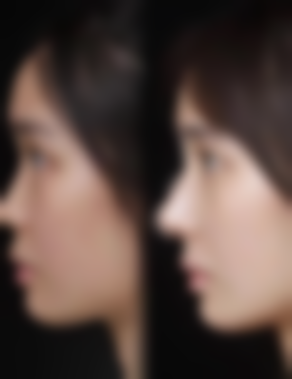 六、达州双均医疗美容医院怎么预约：