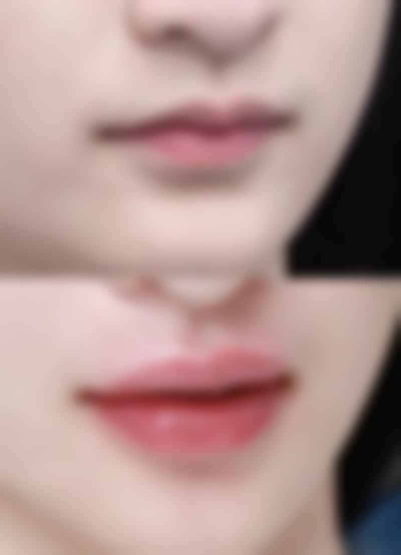 成功实例：疤痕体质者纹眉后的美丽蜕变