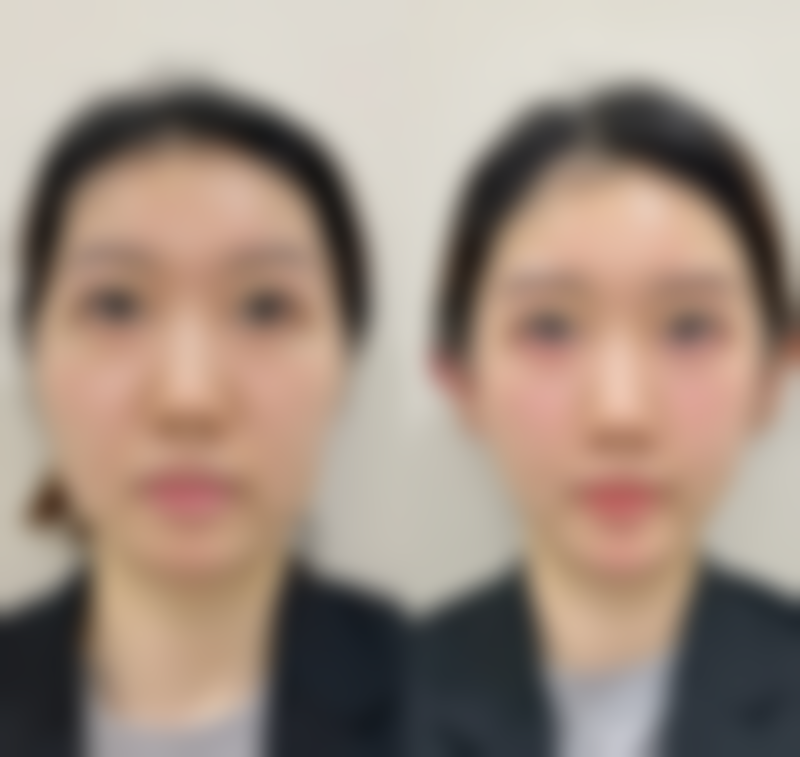 五、牡丹江蒂依夫人整形医院实例