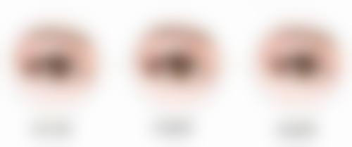 抓伤的伤疤痕迹怎么消除？多种疗法结合，早期干预助力疤痕完美修复 