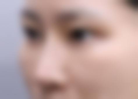 六、佛山汇莹源医疗美容诊所价格表：（仅供参考）