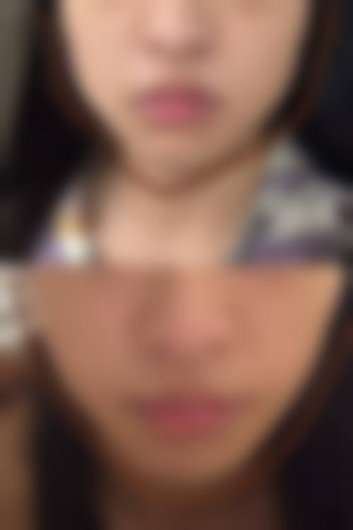 七、扬中曼陀罗医疗美容诊所真实的顾客评价如下：