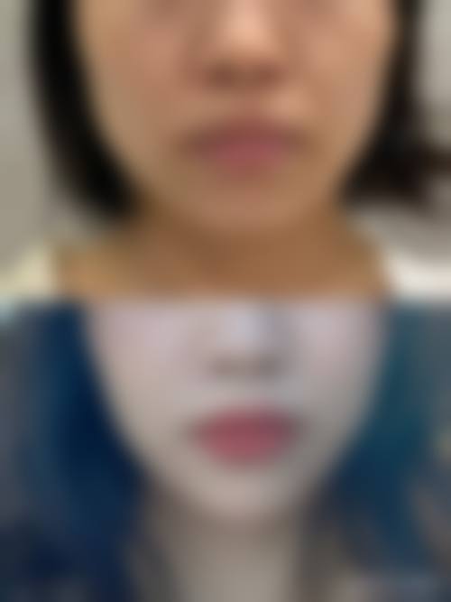 七、佛山汇莹源医疗美容诊所真实的顾客评价如下：