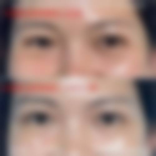 五、佛山汇莹源医疗美容诊所怎么预约：