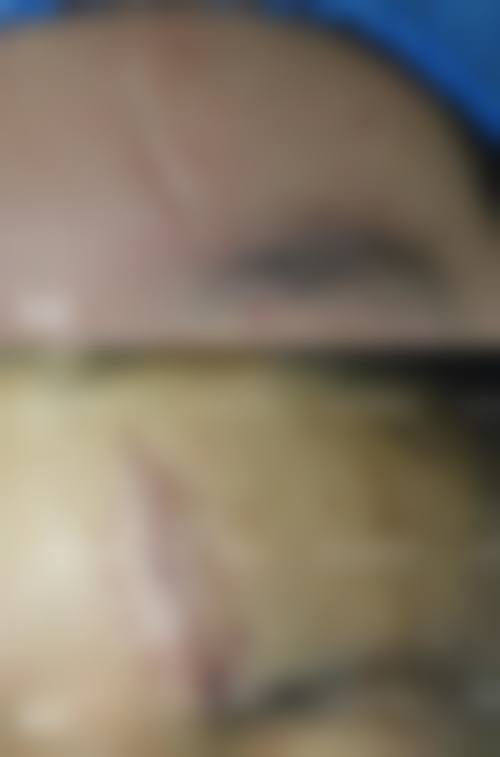 六、泉州市亿星医疗美容门诊部怎么预约：