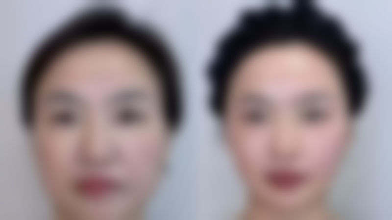 八、历下隅美医疗美容诊所真实的顾客评价如下：