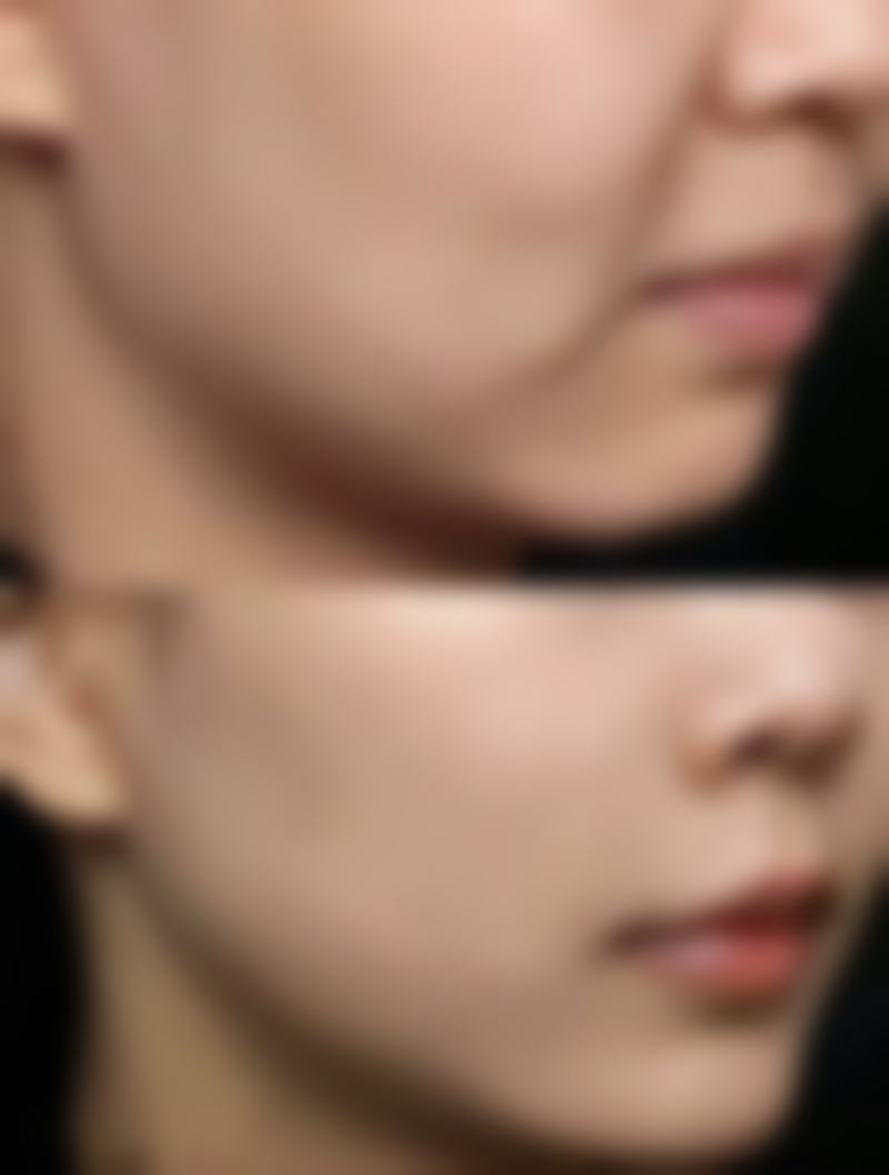 五、郑州慕颜医疗美容诊所怎么预约：