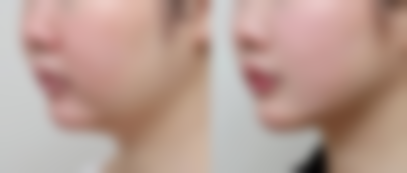 四、郑州慕颜医疗美容诊所实例