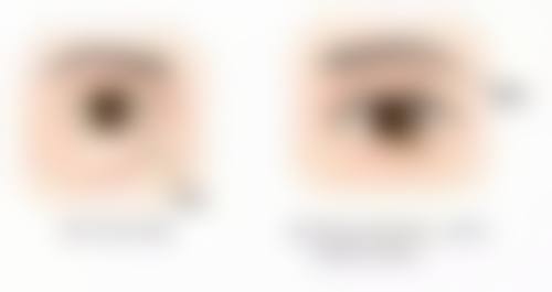 眼部按摩仪真能去除黑眼圈和眼袋吗？多场景适用，还能量化验证功效改善眼周问题 