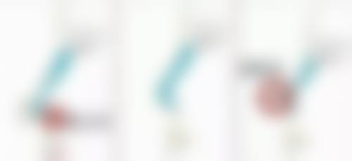 哪些因素影响假体隆胸风险？