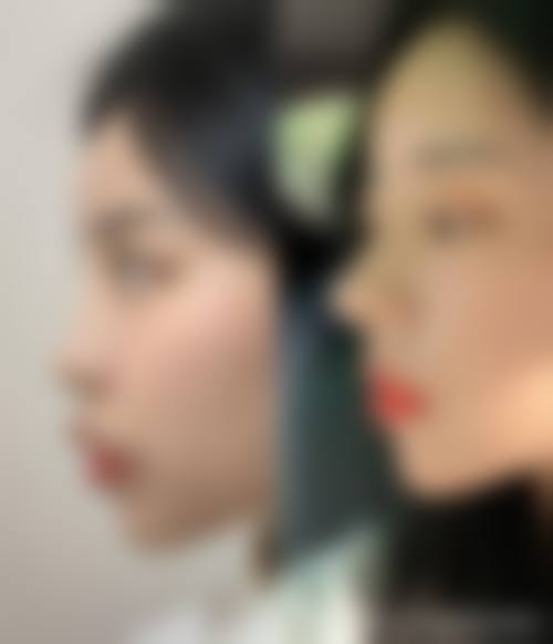 六、太原美雅枫整形美容门诊部怎么预约：