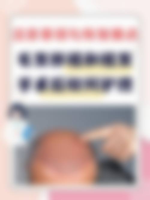 六、济南真程植发医院价格表：（仅供参考）