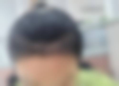 七、济南真程植发医院真实的顾客评价如下：