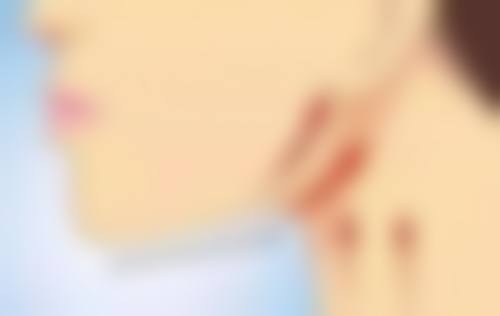 脸上黑色疤痕去除有妙招？维生素E助力，修复肌肤损伤