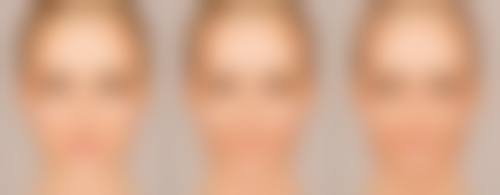 脸上黑色疤痕去除有妙招？医学手段，科学效率高祛疤