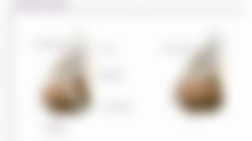 埋线双眼皮成效究竟有啥优势和局限？一看便知