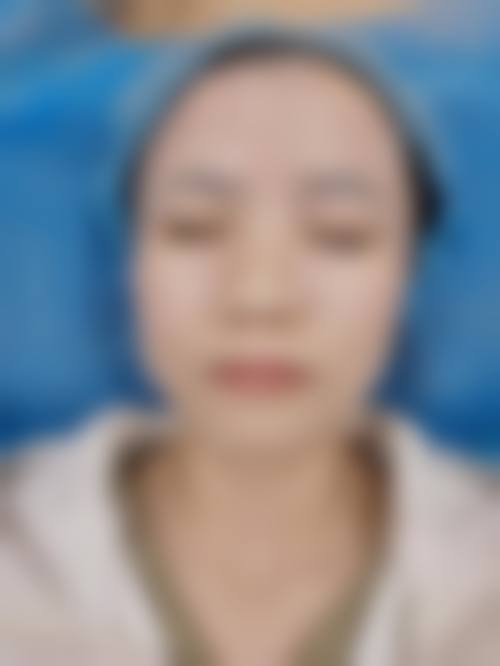 六、岳阳医菲洛医疗美容诊所价格表：（仅供参考）