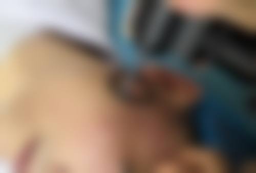 为何会出现一只单眼皮一只双眼皮？——独特优势与乐观看待