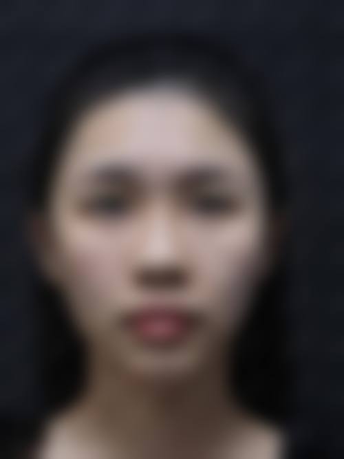七、南京建邺颜迷医疗美容门诊部价格表：（仅供参考）