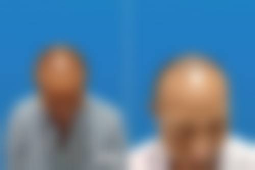 占家佳医生实例