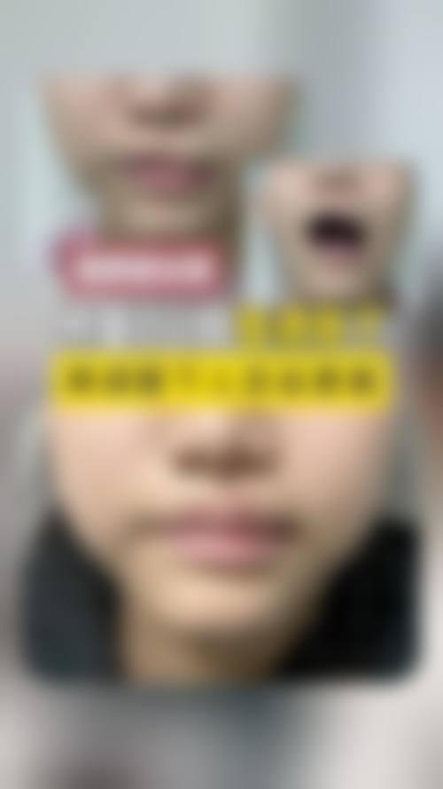 五、海口东湖医学美容医院实例
