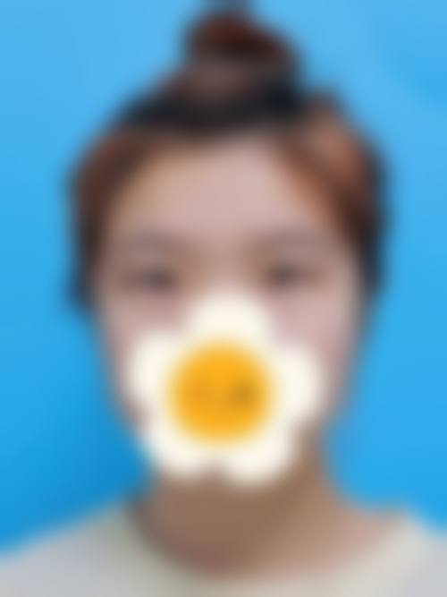 五、深圳之凡（原壹美健）医疗美容门诊部实例
