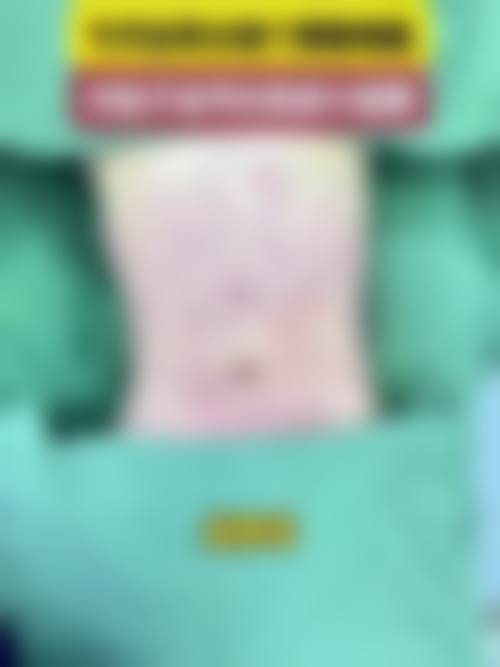 八、新疆苏瑶创美医疗美容整形诊所真实的顾客评价如下：