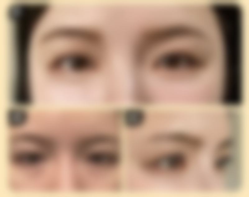 纯牛奶成分助力，改善眼袋有优势