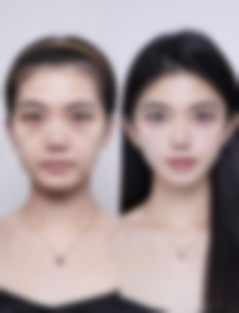 五、张家界维纳斯整形医疗美容医院实例