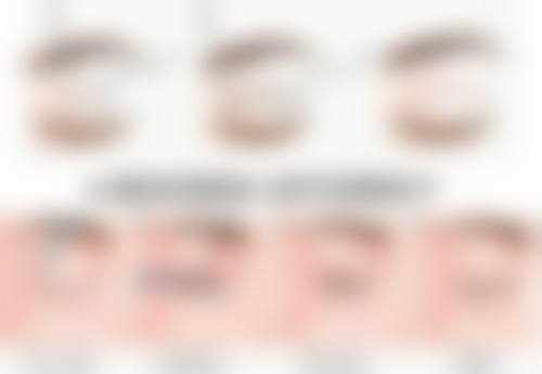 甘油联合其他成分，对去眼袋有帮助吗？