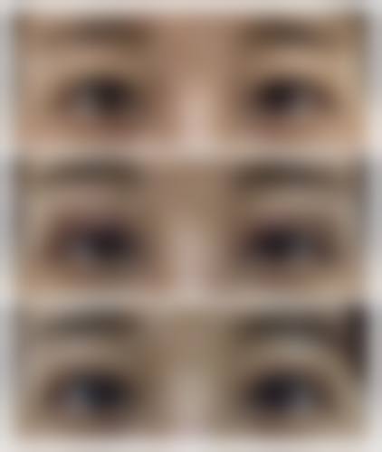 金仁键医生实例